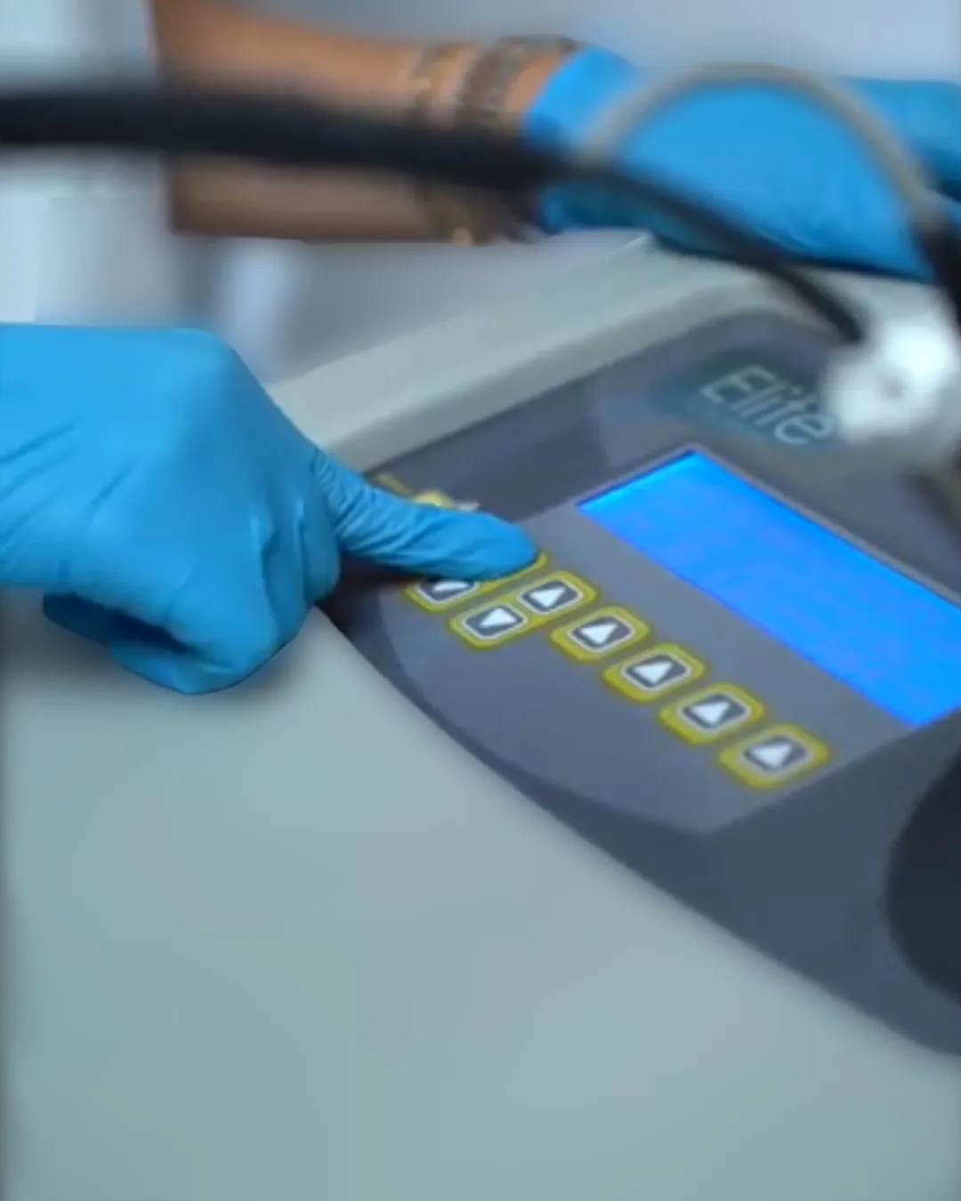 Réglage des paramètres de la plateforme laser Cynosure Elite+ au cabinet à Casablanca